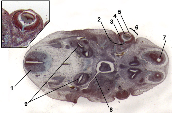 eye embryology