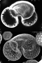 Conventionele versus confocale fluorescentie microscopie