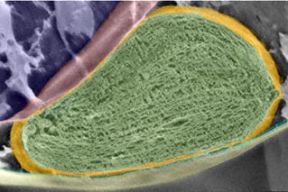 Scanning elektronen microscopie van een chloroplast