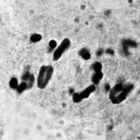 meiose: anafase I in Locusta