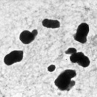 meiose: polair aanzicht metafase I in Locusta