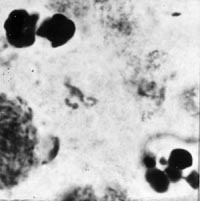 meiose: telofase I in Locusta