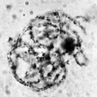meiose: zygoteen in Locusta