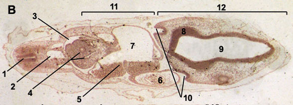 Cross section through an embryo of chicken 72 hours after fertilization