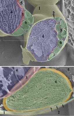 SEM opname van gebroken sponsparenchymcellen met chloroplasten