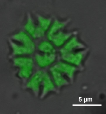 desmid: bright field fluorescence of chloropplast