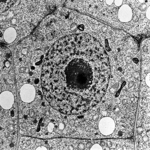 voorbeeld van TEM van een plantencel: worteltop cel